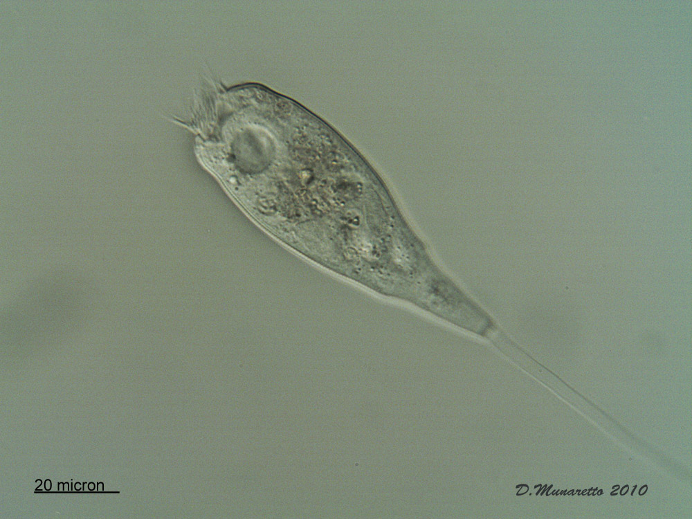 Vorticella